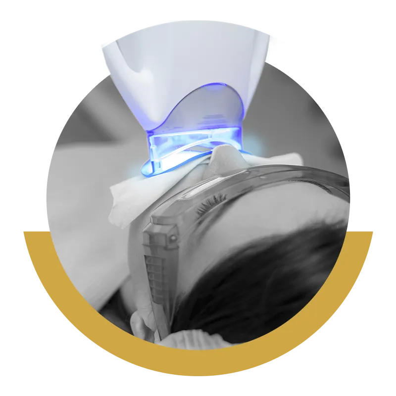 Blanqueamiento dental Pamplona