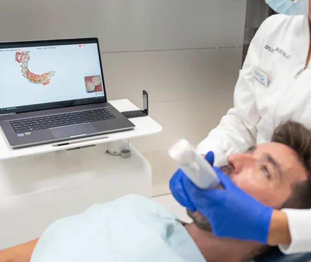 Escaner-intraoral